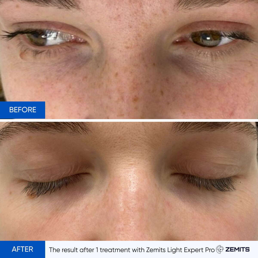 Zemits Light Expert Pro