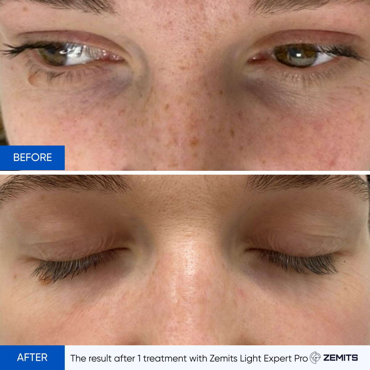 Zemits Light Expert Pro