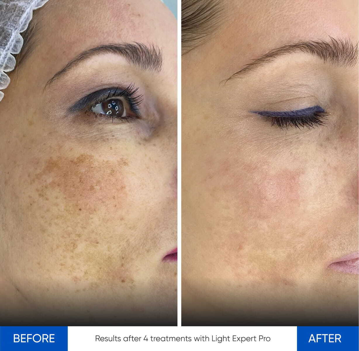 Zemits Light Expert Pro