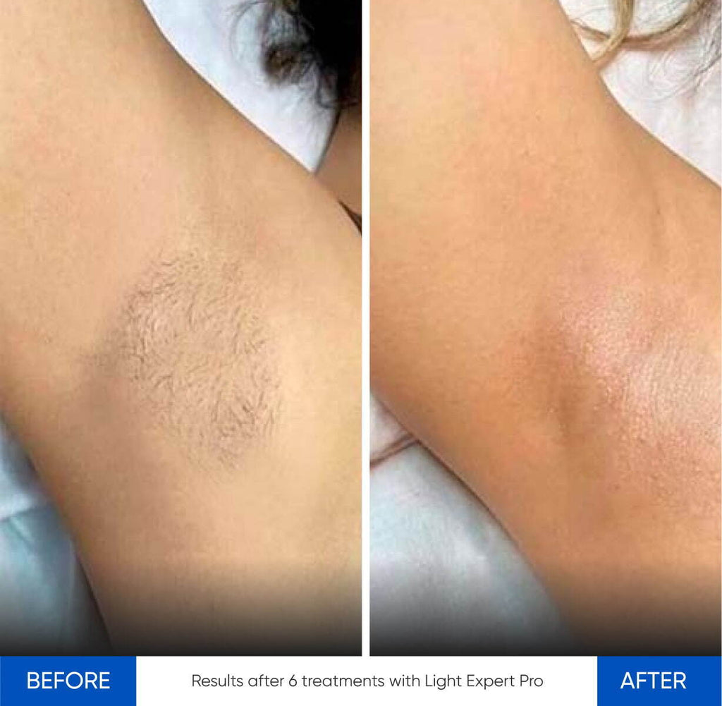 Zemits Light Expert Pro